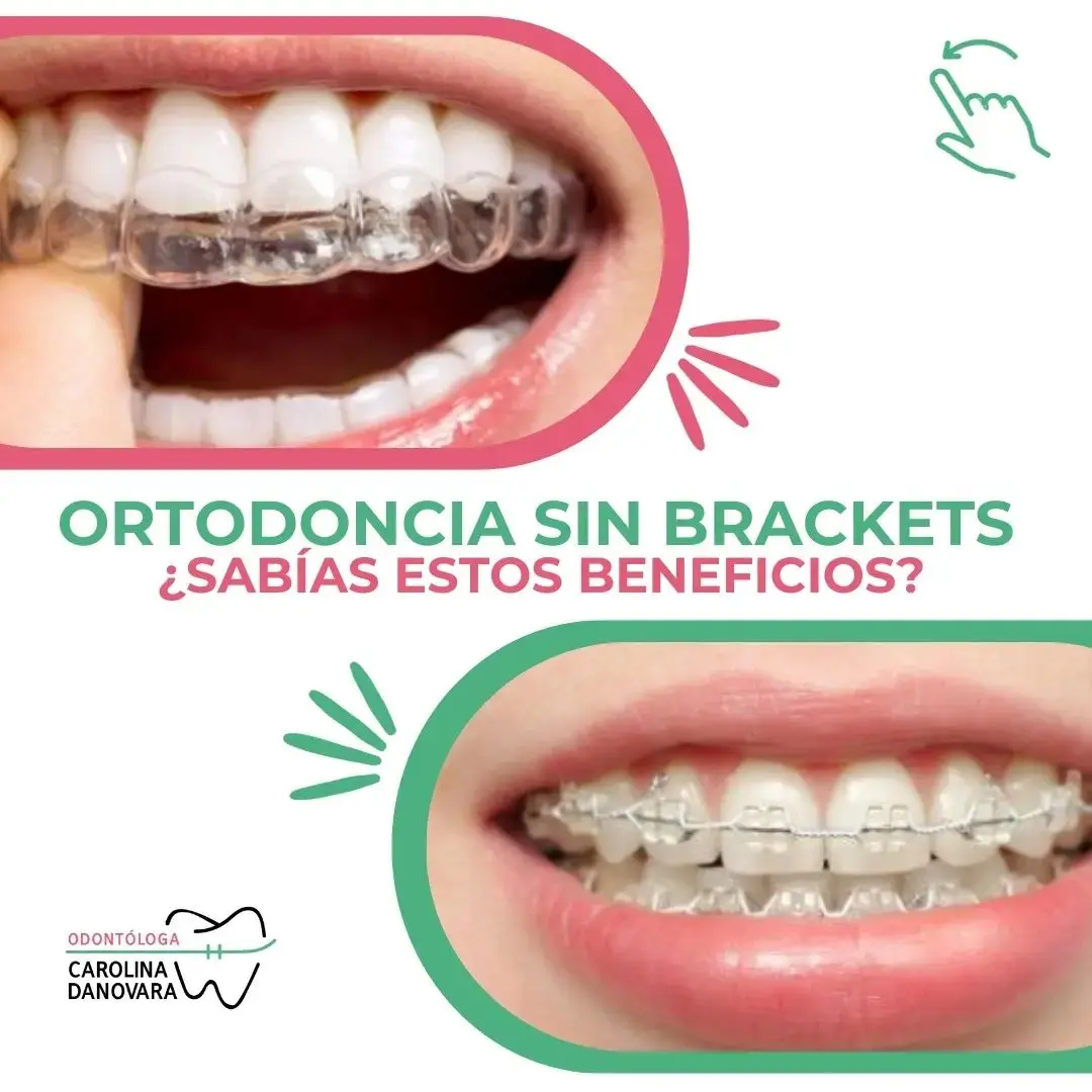 Características Principales