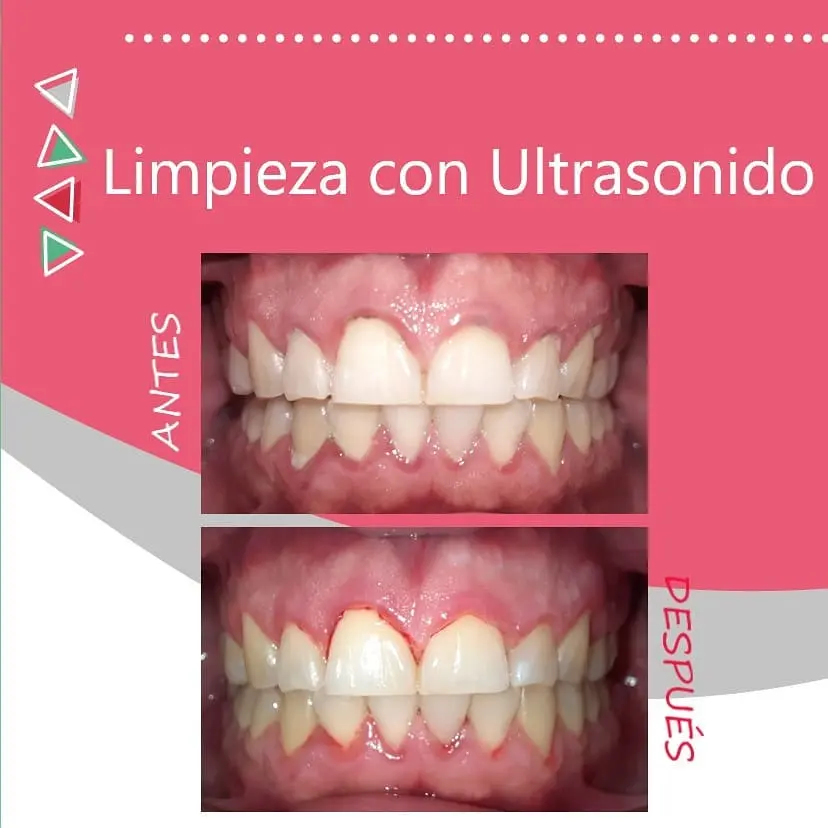 Prevención y Mantenimiento